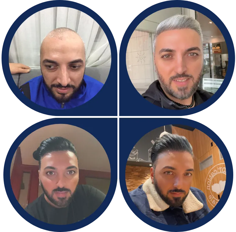 Before & After Image